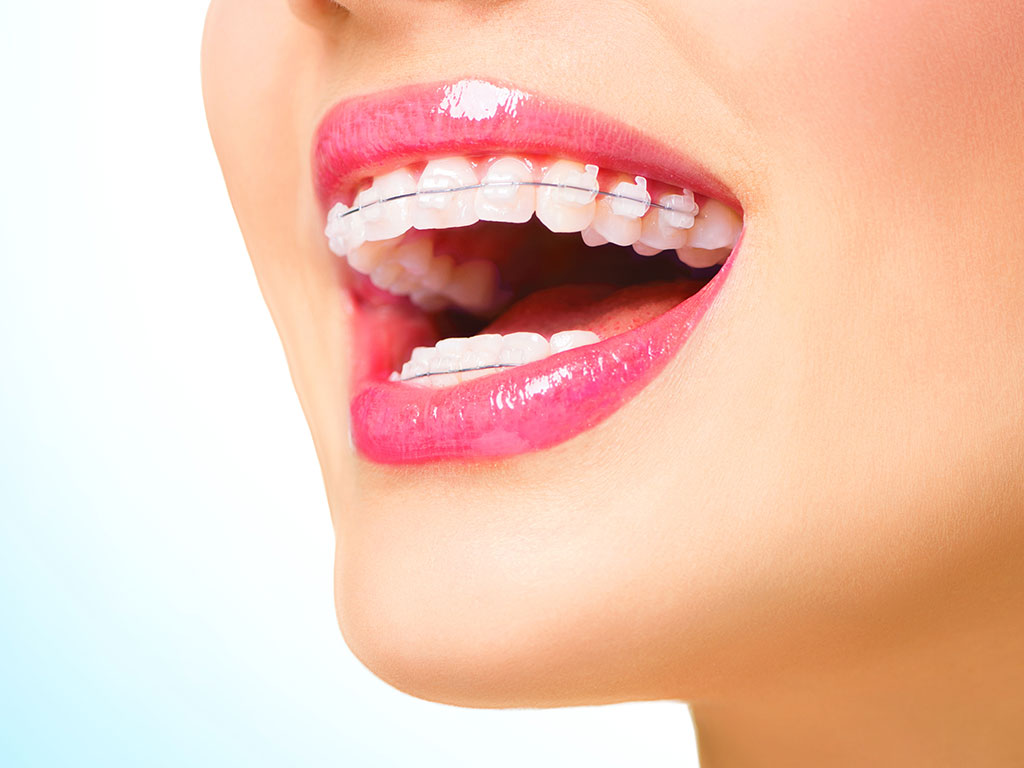 Orthodontic Treatment Twickenham Claremont Dental Practice 8604